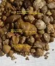 oxgallstones