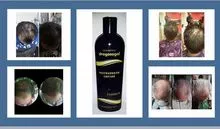 洗发水龙戈加尔