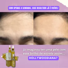 imagem dos produtos